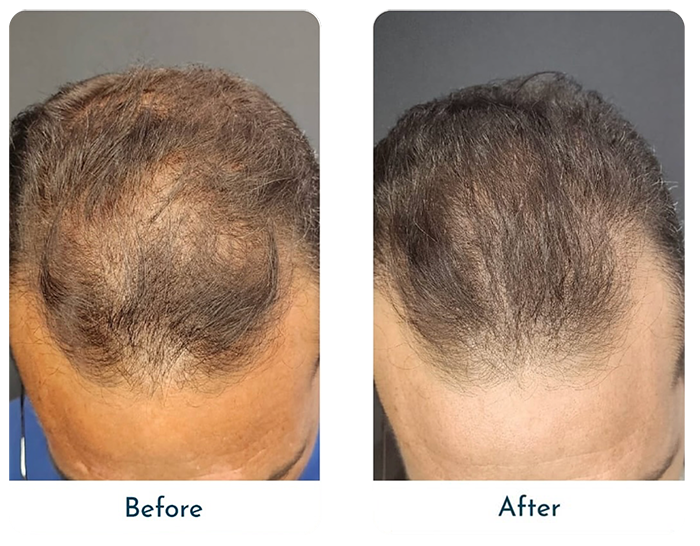 Before-&-After-1