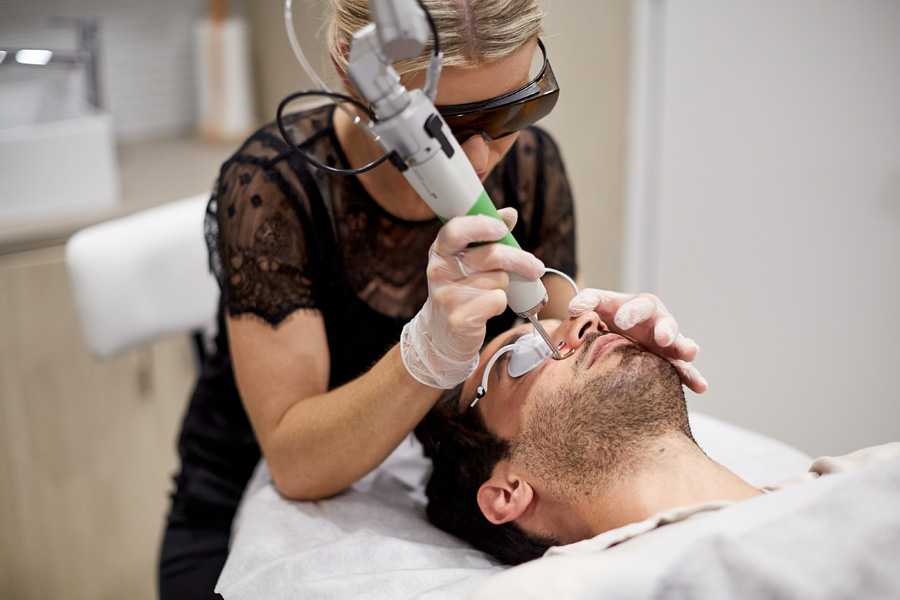 Sydney man receiving Pico toning correcting skin treatment in the Face of Man clinic