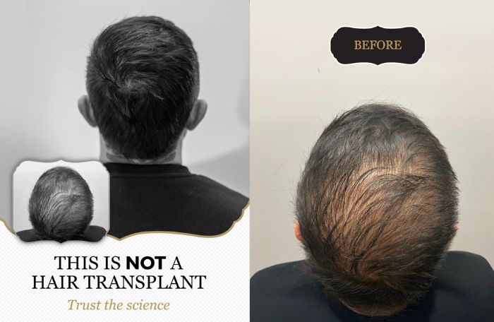 Ash hair restore client and his before and after results