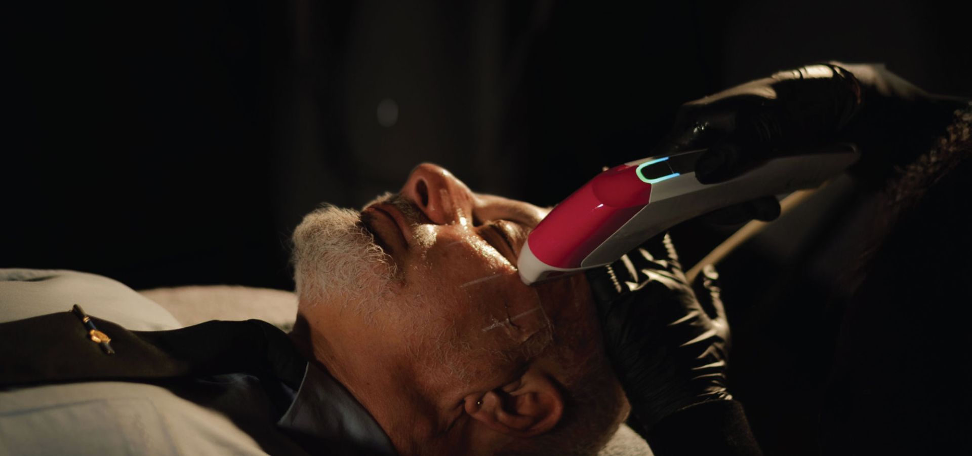 Male receiving ultraformer mpt powerlift treatment at face of man